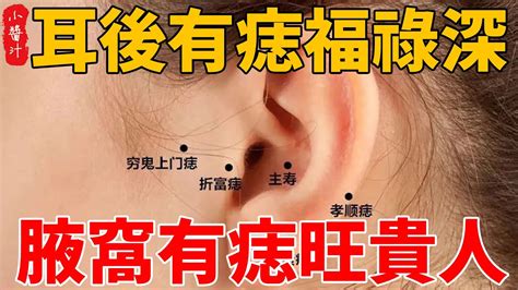 耳後有痣暗藏財|7個招桃花、招財「痣」介紹！耳朵痣錢途不可限量，。